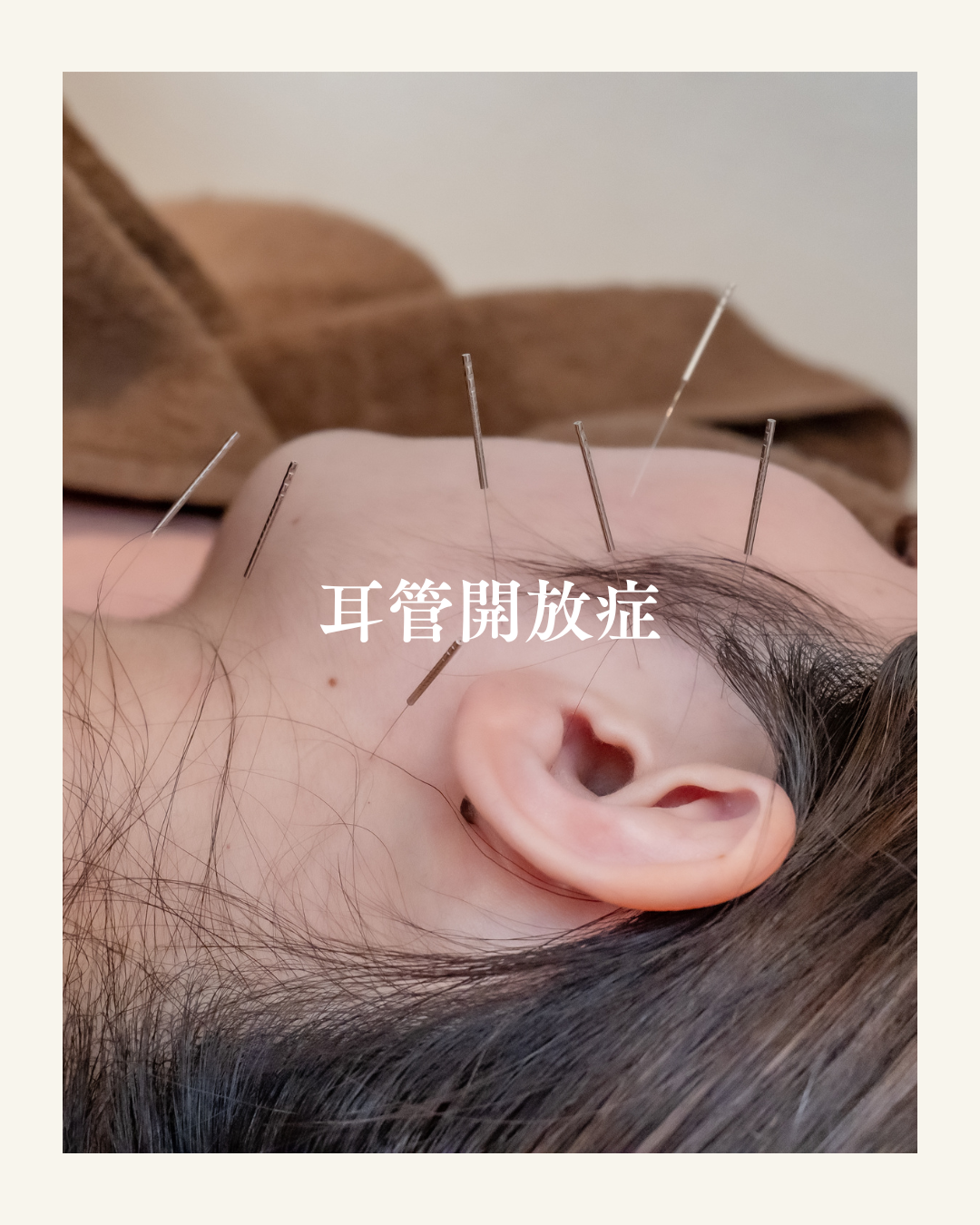 肋間神経痛の主な症状 (10)